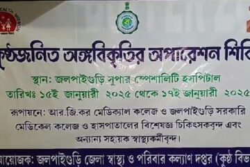 जलपाईगुड़ी मेडिकल कॉलेज अस्पताल में कुष्ठ रोगियों की चल रही है जटिल सर्जरी