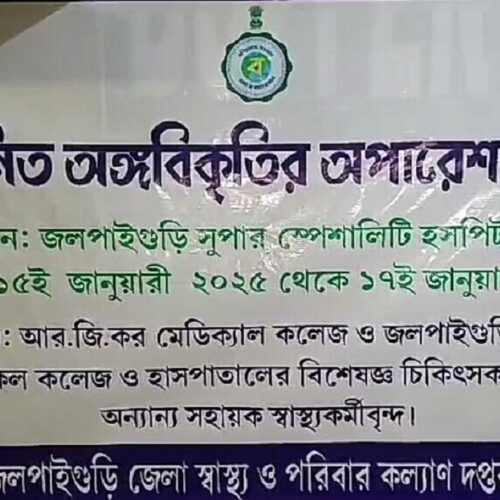 जलपाईगुड़ी मेडिकल कॉलेज अस्पताल में कुष्ठ रोगियों की चल रही है जटिल सर्जरी